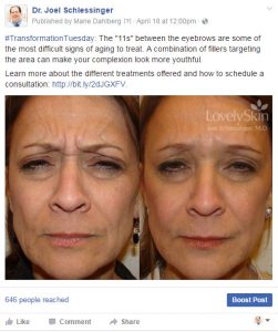 Dr. Joel Schlessinger - Before and After Injections